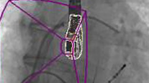 EchoNavigator 1 desktop