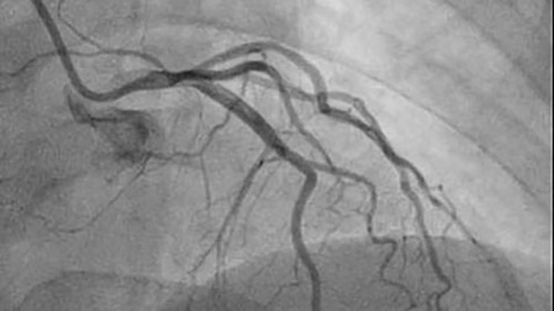 allura centron 5 desktop