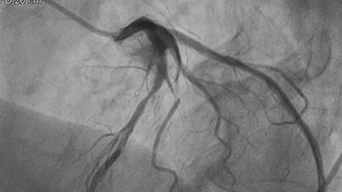 alluraclarity with clarityiq desktop