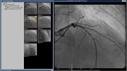 xcelera image management desktop
