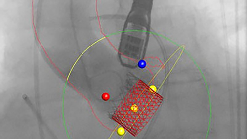 heartnavigator desktop