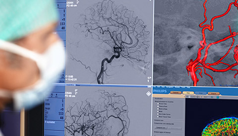 Treating vascular diseases and cancer