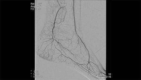 allura clarity clarityiq endovascular 3 desktop