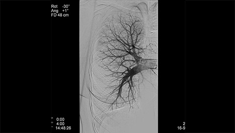 allura clarity clarityiq endovascular 5 desktop