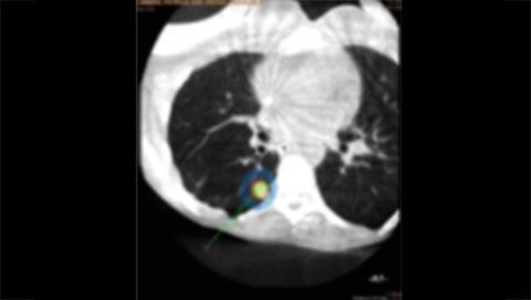 xperguide ablation 1 desktop