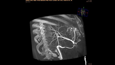 xperguide ablation 2 desktop
