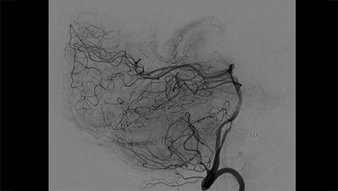 allura clarity clarityiq 2 desktop