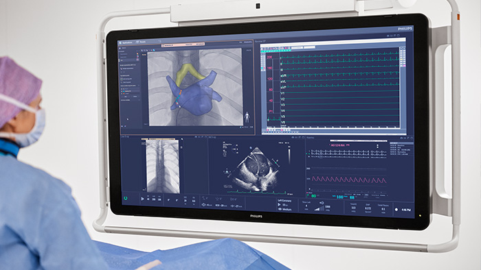 Atrial fibrillation procedures