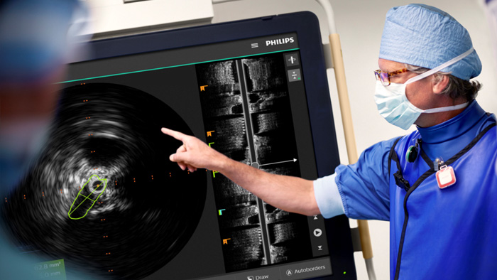 Venous procedures