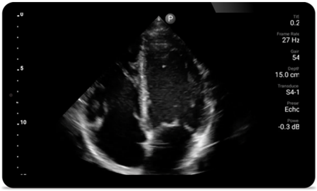 Third case image