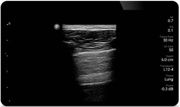 Second case image